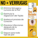 Eliminador de verrugas